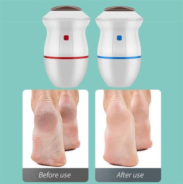 Electric Foot Grinder, Callus Remover