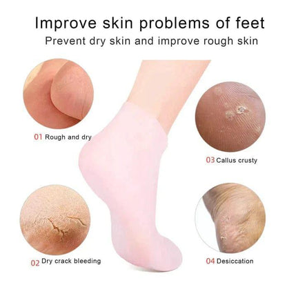 Moisturizing Silicone Gel Socks
